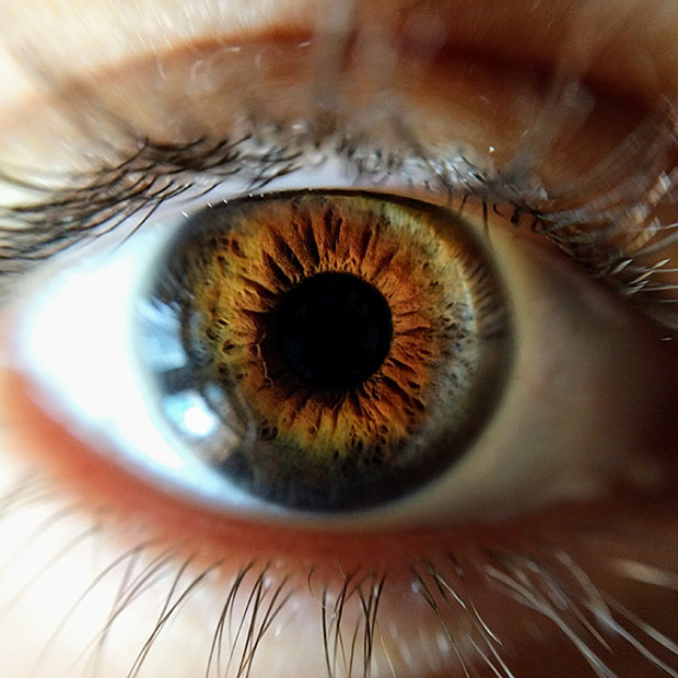 How Autoimmune Diseases Impact Eyesight | Vision Source Mandan