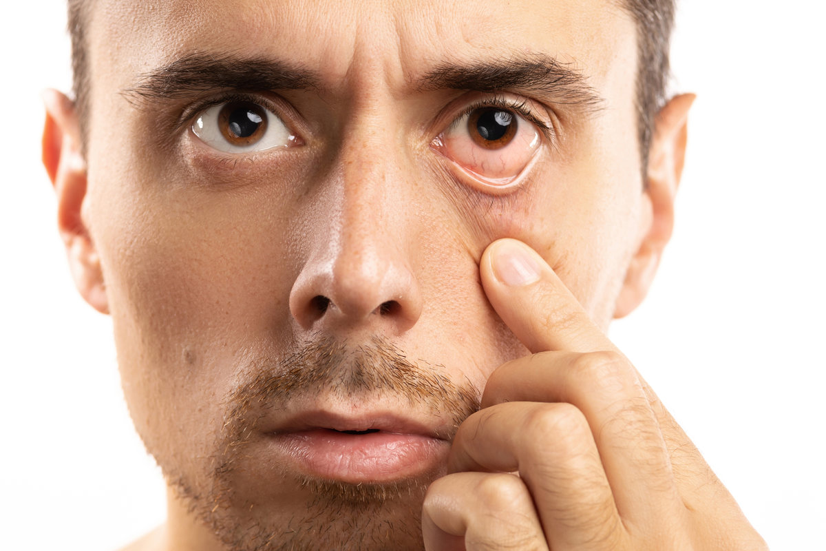 Man checking condition of his eye on white background