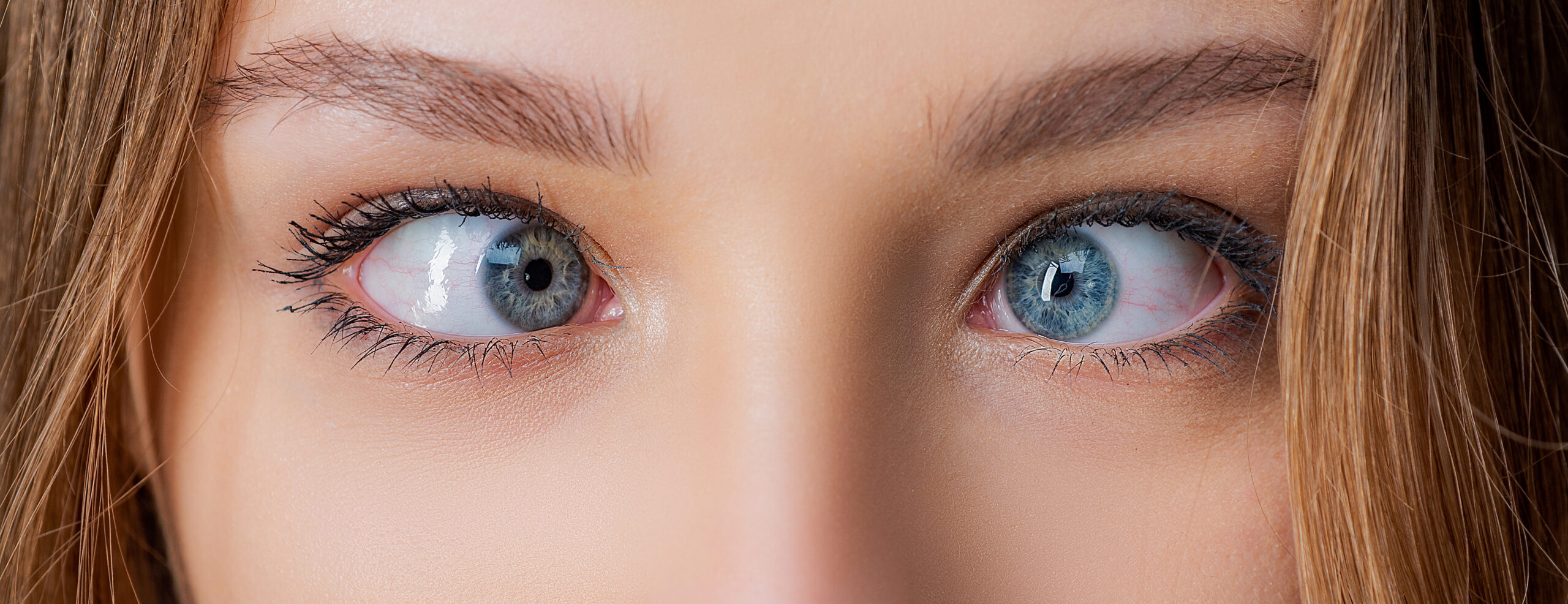 Eyes with squinted look and eyebrows on male face. Female eyes with strabismus. Hypertropia. Woman eyes suffering from strabismus - close up