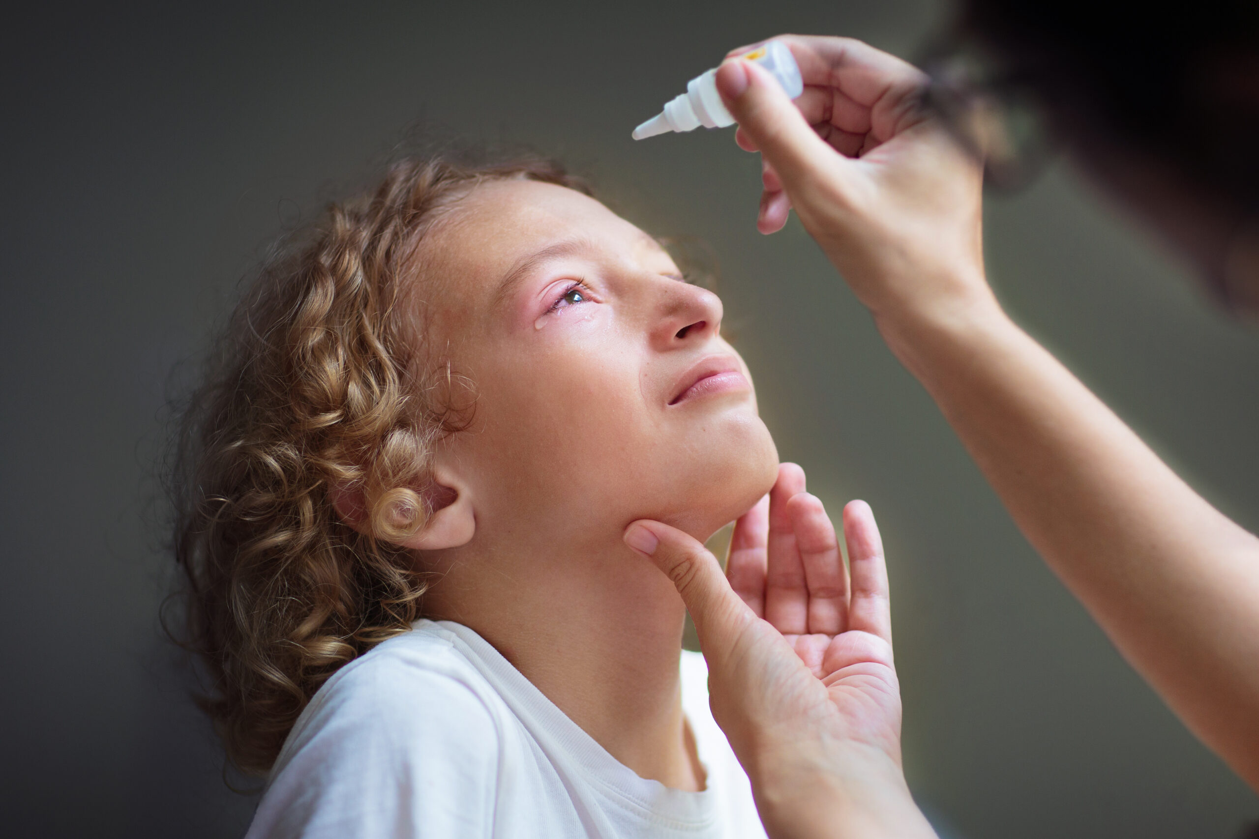 Child with swollen pink eye. Eyes infection and pollen allergy. Allergic little boy with runny nose and red eyes. Sick kid at doctor or hospital.